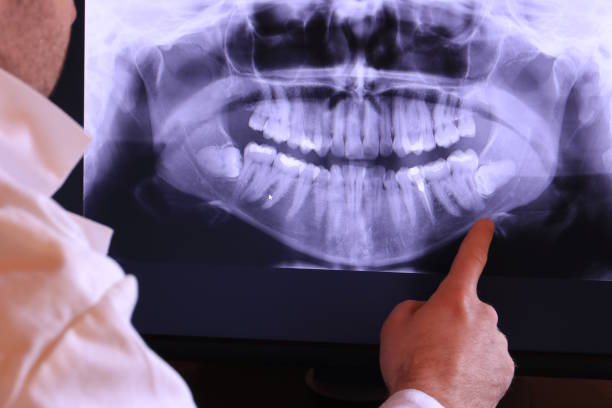 Best Broken or Chipped Tooth Repair in USA